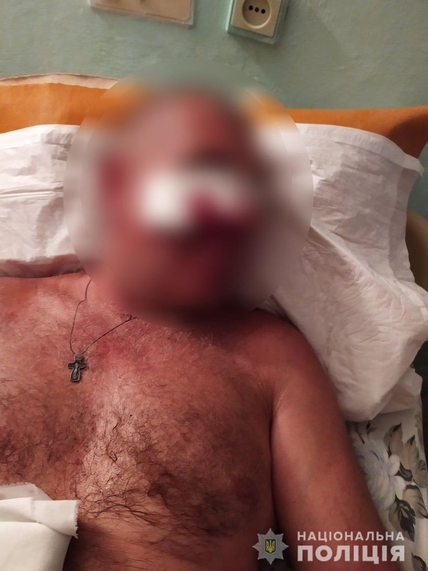 В Умані побили чоловіка