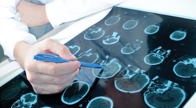 https://www.meddiagnostica.com.ua/uk/shho-mi-likuiemo/nevrologiya/